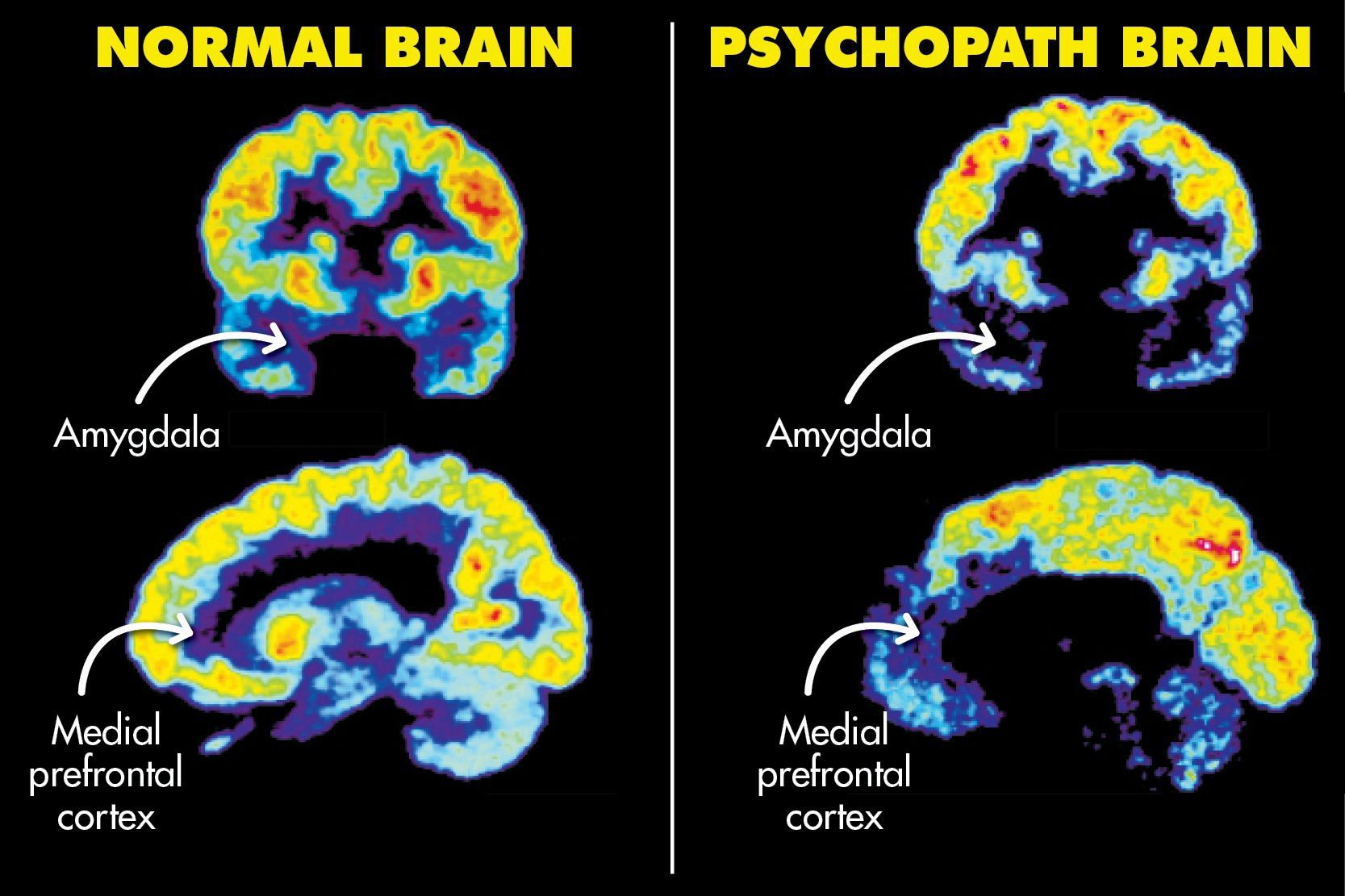 Brain Health