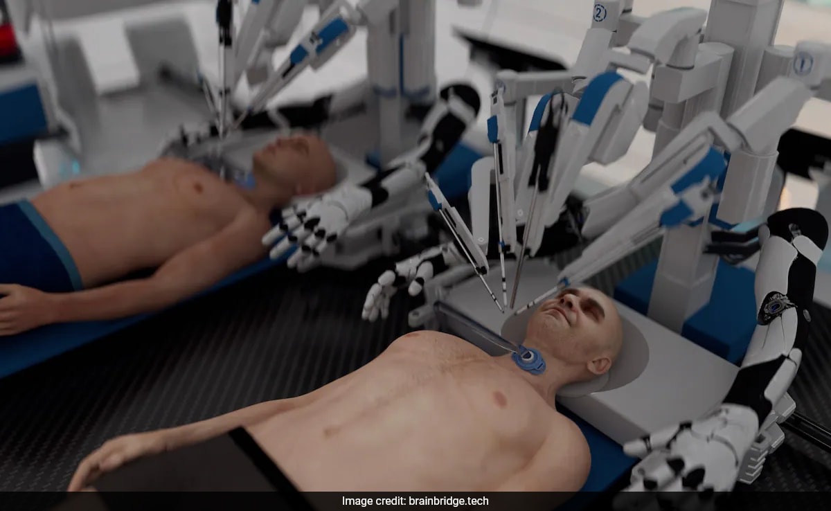 World's first human head transplant project launched